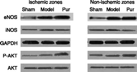 Figure From The Effect Of Puerarin On Serum Nitric Oxide