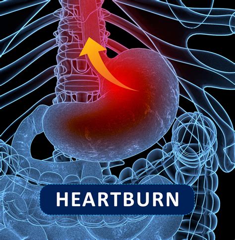 Jena In Boala Hemoroidala Cauze Simptome Prevenire Si Tratament Hot