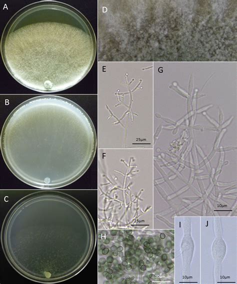 Morphological Characteristics Of Trichoderma Attinorum Ac Cultures On