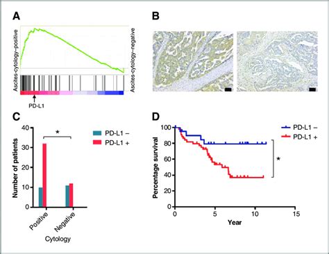 Pd L1 Expression On Human Ovarian Cancer Cells Is Related To Tumor Download Scientific Diagram