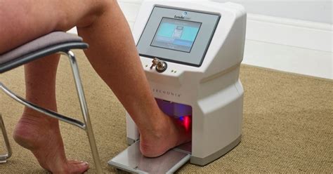 How Does The Fungal Nail Laser Work Advance Foot Clinic