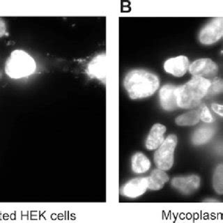 Polymerase chain reaction (PCR)-based assay detected mycoplasma ...