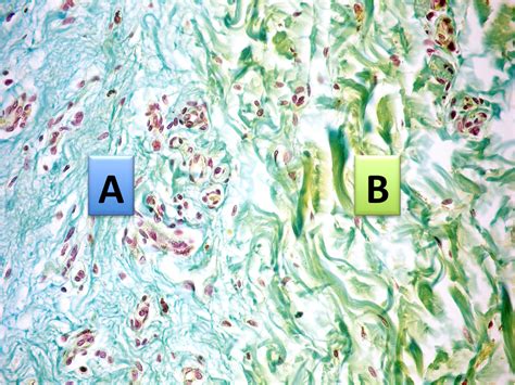 Sos Biologia Celular Y Tisular Tejidos Conectivo Dermis