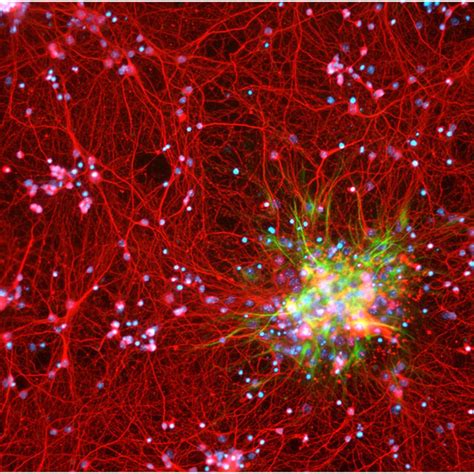 These Two Images Show Astrocytes From Mouse Cortical Cell Culture