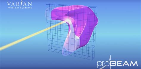 Pencil Beam Scanning Proton The Best Picture Of Beam