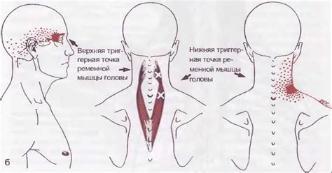 Ременная мышца головы и шеи: функции