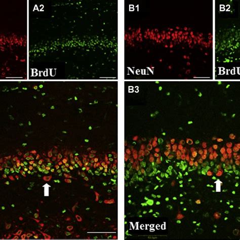 Granulocyte-colony stimulating factor (G-CSF) therapy restored ...