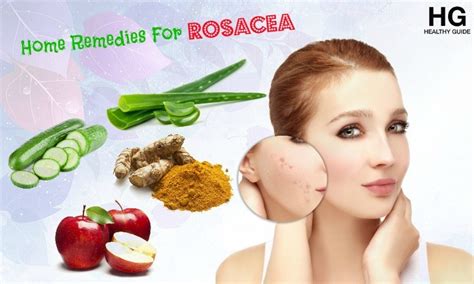 17 Home Remedies For Rosacea Rash On Facial And Body Skin