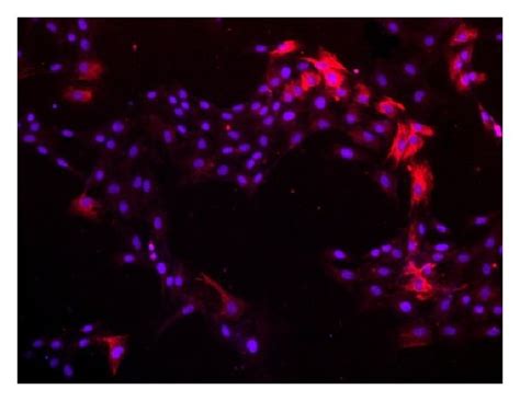 Stellate Shape Like Cell Expression Of A α Sma B Vimentin And C