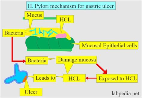 Helicobacter Pylori H Pylori Presentation And Diagnosis