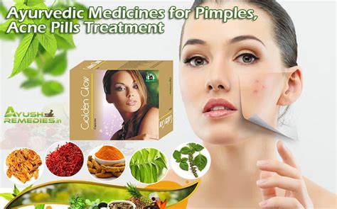 Ayurvedic Medicines For Pimples Acne Pills Cure Treatment