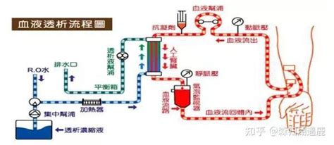 血液透析基础知识 知乎