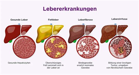 Fortbildung