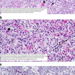 A Low Power Magnification Of Hematoxylin Eosin H E Stained Sections