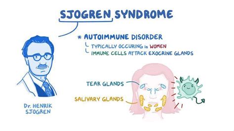 Sjogren Syndrome Medizzy