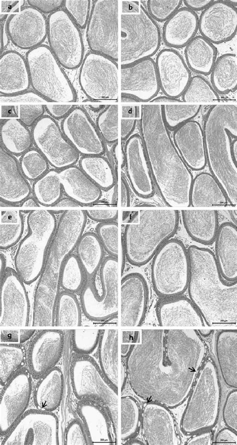 Longitudinal Sections Of The Epididymis From Male Rats From Control And