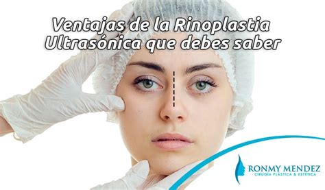 Ventajas De La Rinoplastia Ultrasónica Que Debes Saber