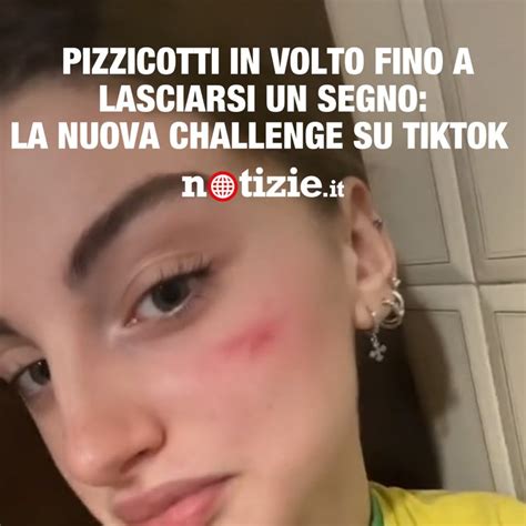 Cicatrice Francese La Pericolosa Nuova Challenge Di Tiktok Che