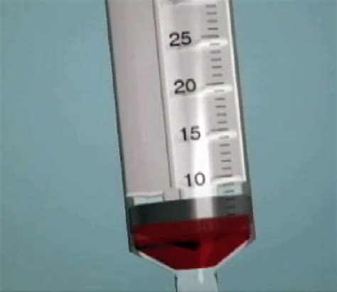 Stem Cell Injections for Knee Arthritis – What are the Options? - Stemcell Therapy in California