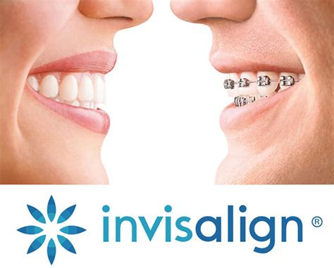 Invisalign Okc Invisalign And Clear Braces Treatment Oklahoma