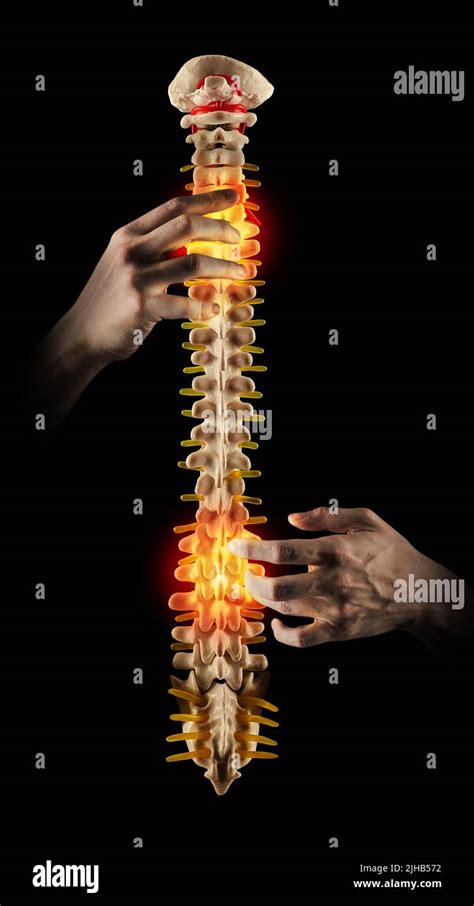 Quiropráctica concepto Quiropráctico profesional que trata la columna