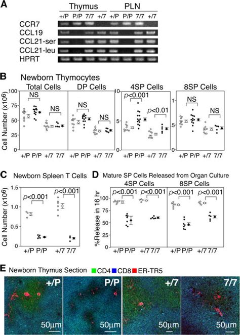 Characterization Of Thymuses Of Newborn Ccr Or Ccr L Deficient Mice