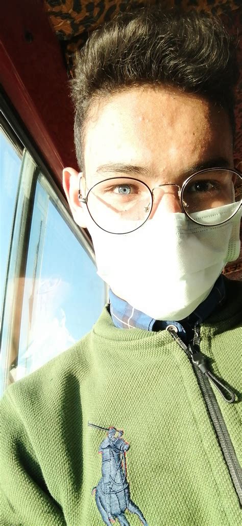 ( Heterocromia ) 💙 : r/pics