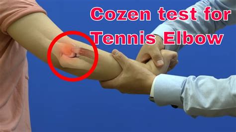 Lateral Epicondylitis Test 3d Cozen Test Youtube