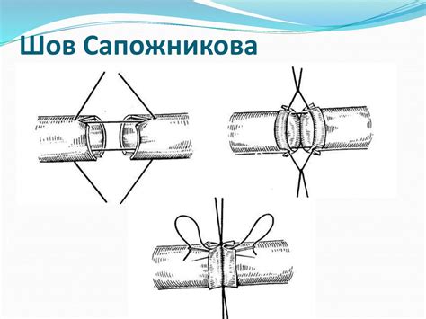 Сосудистый шов - online presentation