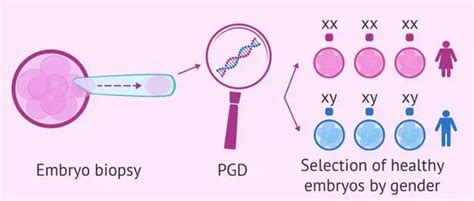 Controversial Gender Selection Technique Lets You Choose The Sex Of