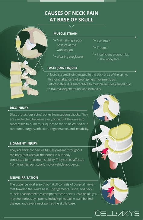 Neck Pain At Base Of Skull: Symptoms, Causes, And Treatment - Cellaxys