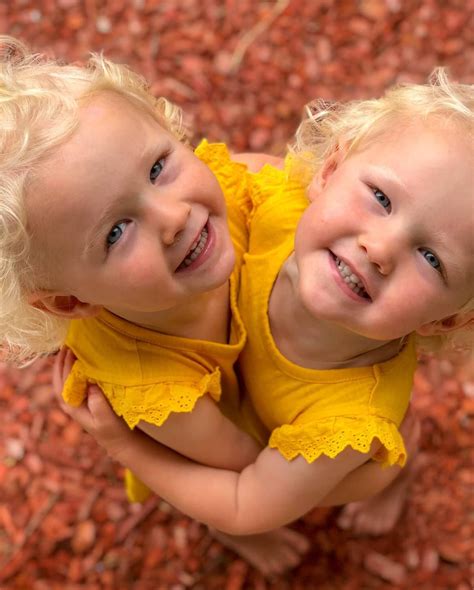 Identical Twins With Different Hair Color