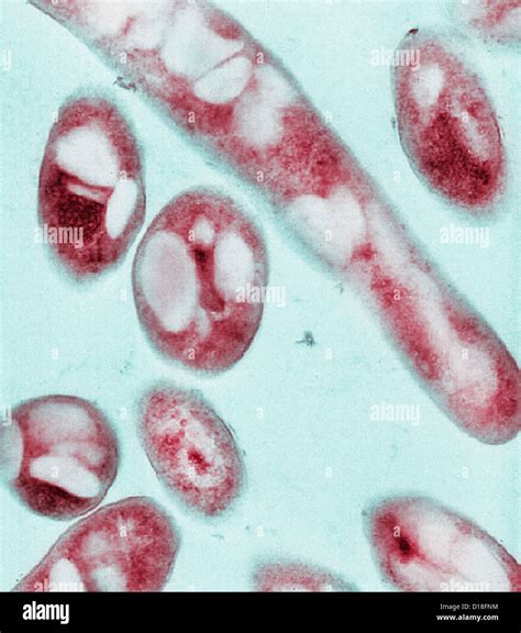 Electron Micrograph Of Bacillus Anthracis Bacteria Stock Photo Alamy