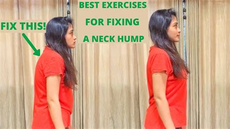 Quick 4 Minute Fix For Neck Hump 2 Easy Exercises To Fix Rounded Shoulders Workitout Youtube