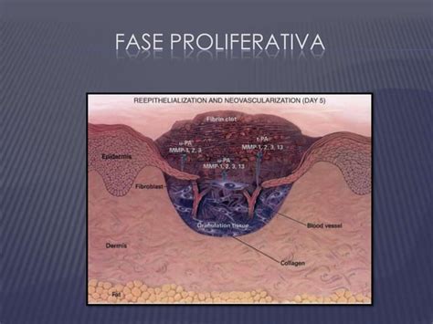 Seminario Anastomosis Intestinales PPT