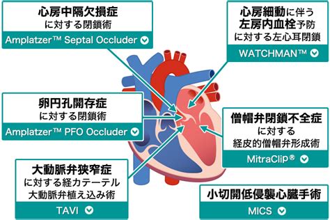 鹿児島大学病院 心血管病低侵襲治療センター（患者様へ）｜鹿児島大学 心臓血管・高血圧内科学