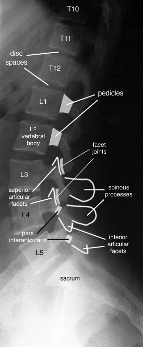 Radiology Schools, Radiology Student, Radiology Imaging, Medical Imaging, Nursing Study, Nursing ...