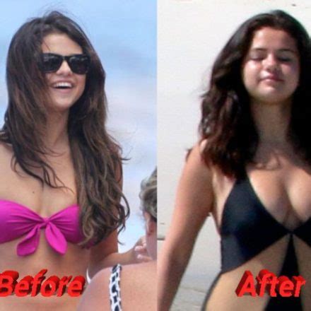 Selena Gomez Nose Job Plastic Surgery, Really?