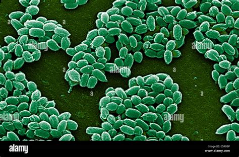 Bacillus Anthracis Spores Fotograf As E Im Genes De Alta Resoluci N Alamy