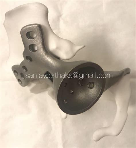 Another First in India: 3D Printed Titanium Implant Helps Man Regain