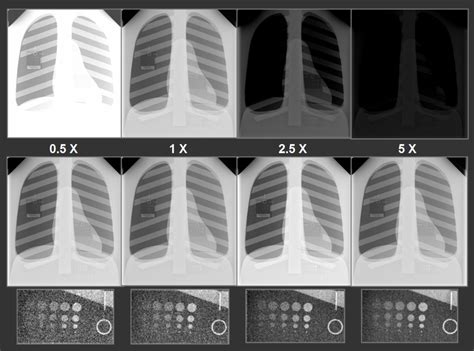 Exposure Issues | Radiology |SUNY Upstate Medical University