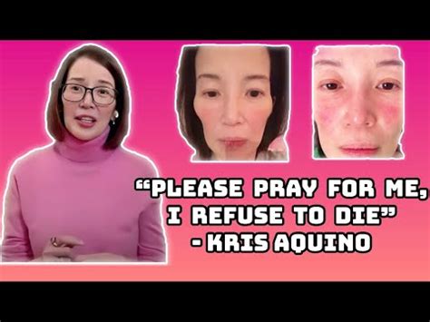 Kris Aquino Full Interview Prayers Update On Her 5 Autoimmune