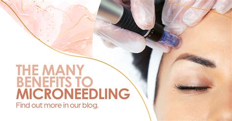 All You Need To Know About Microneedling Alamo Heights Dermatology