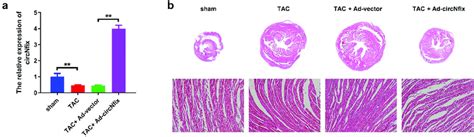 Circnfix Protected Mice Against Tac Induced Cardiac Hypertrophy A