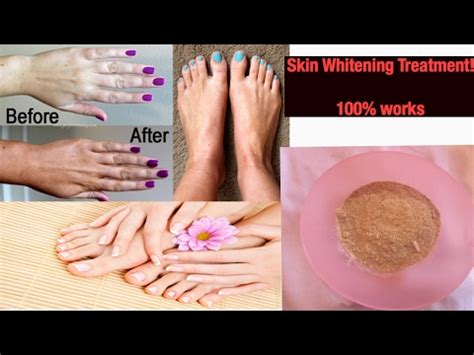 How To Lighten Body Skin Color In 3 Days Legs Hands Neck YouTube