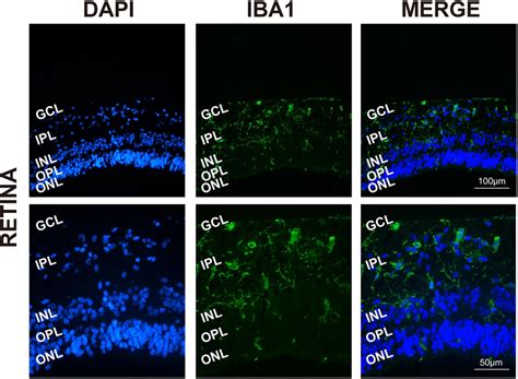 Frontiers Isolation And Characterization Of Primary Retinal Microglia