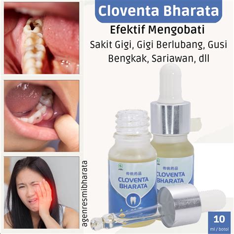 Jual Obat Sakit Gigi Paling Ampuh Cloventa Bharata Cepat Atasi