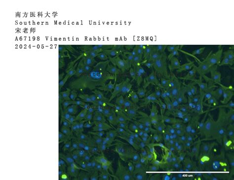 使用Nature Biosciences品牌抗体 Review 持续更新00002 Nature Biosciences kit mAb