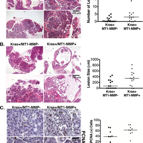 Mt1 Mmp Expression In Kras G12d Mice Promotes Pancreatic Fibrosis