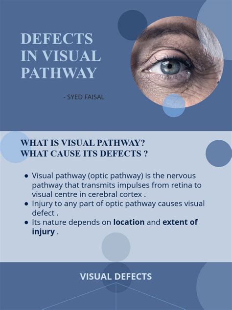 Defects in Visual Pathway | PDF | Visual System | Diseases And Disorders